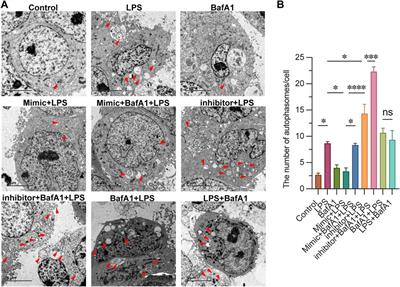 FOXO1-mediated autophagy regulation by miR-223 in sepsis-induced immunosuppression